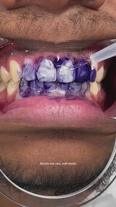 Hismile - Teeth Brightening Serum V34 (Original)